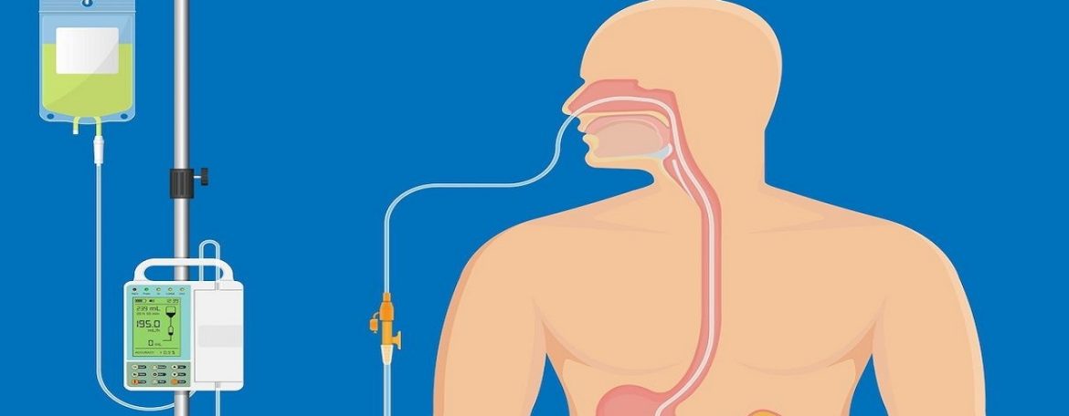 Enteral Feeding Devices Market